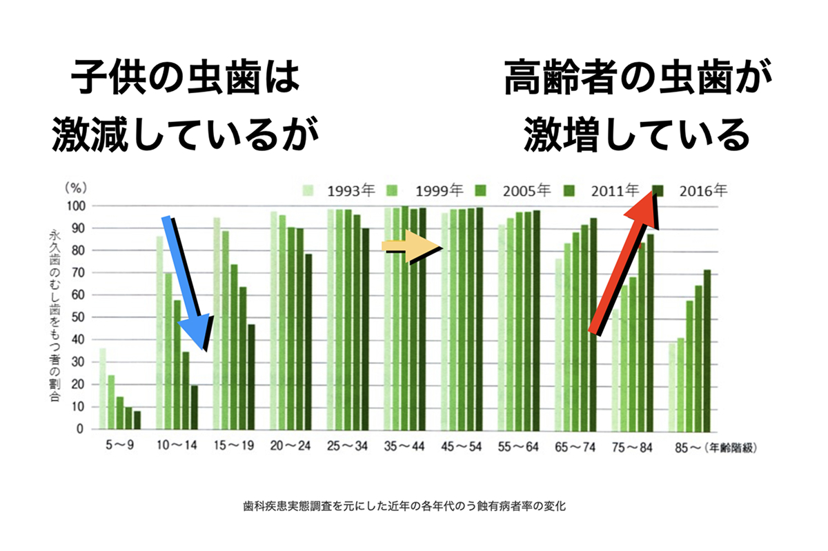 年代別に永久歯のむし歯を持つ人の割合を示した棒グラフ。子ども世代では年々むし歯が減少している一方、高齢者ではむし歯が増加している傾向が矢印で示されている。