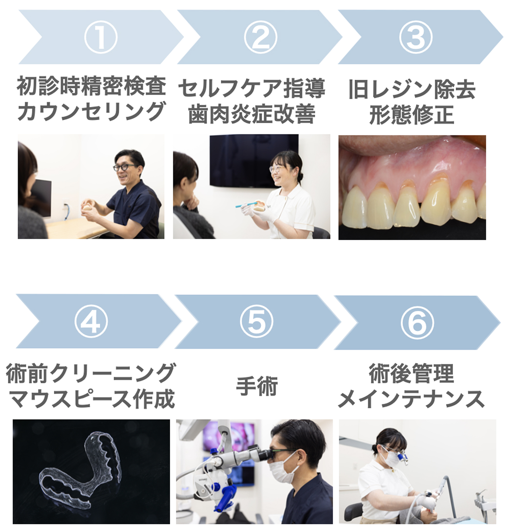 歯周治療の流れを6段階で示した図。初診時の精密検査とカウンセリング、セルフケア指導と歯肉炎の改善、旧レジン除去と形態修正、術前クリーニングとマウスピース作成、手術、術後管理とメインテナンスの順に写真付きで説明している。