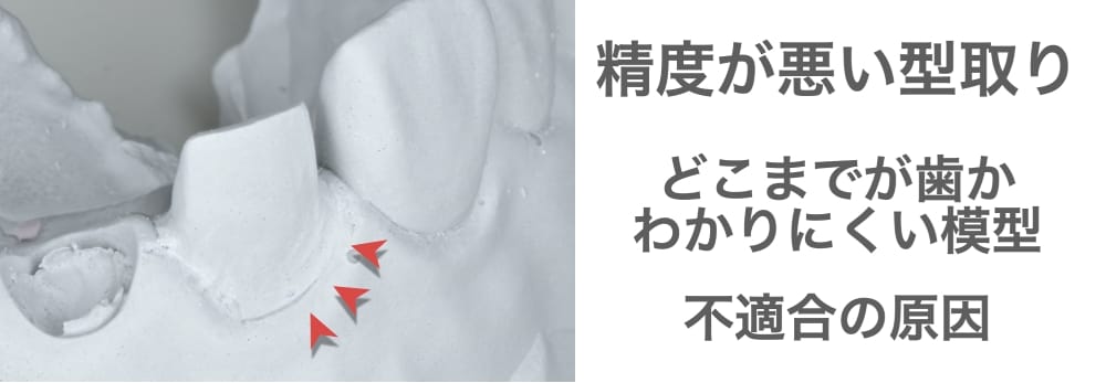 image_tooltip 精度が悪い型取り