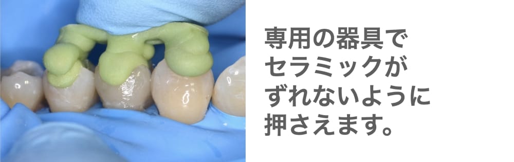 image_tooltip セラミックがずれないように押さえる様子