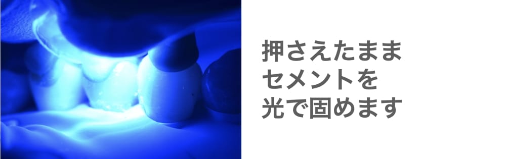 image_tooltip セメントを光で固める様子