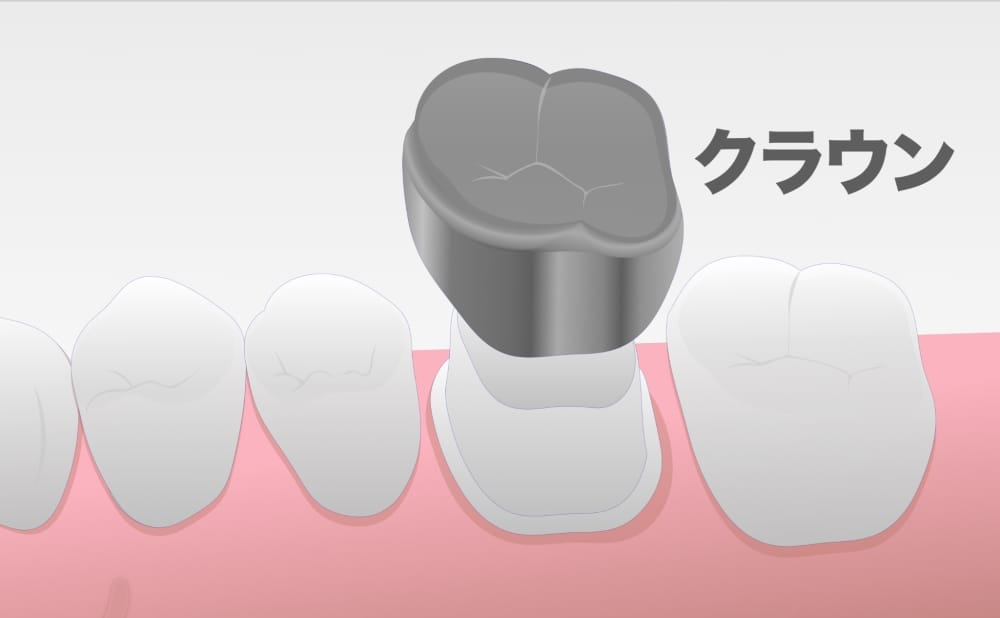 image_tooltip クラウン