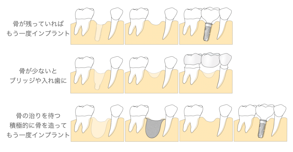 もし撤去が必要になったら、次はどうなる？