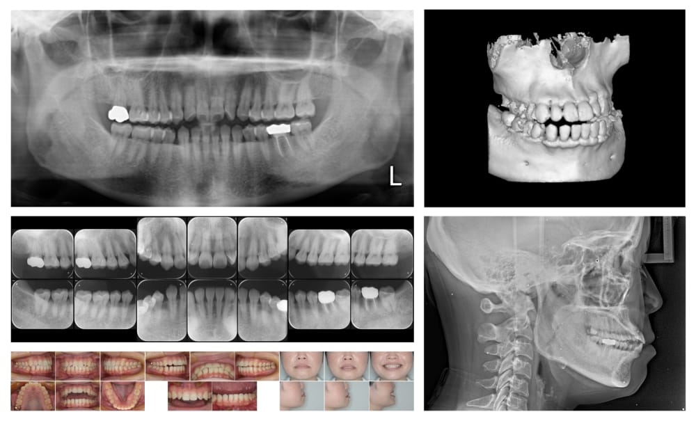 精密検査でリスクを把握