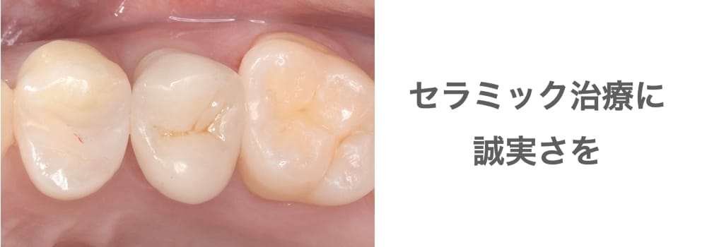 セラミック治療に誠実さを