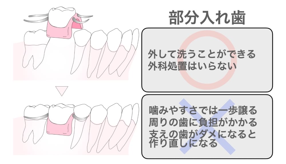 alt_text