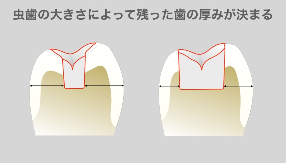 image_tooltip alt_text