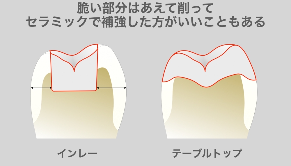 image_tooltip alt_text