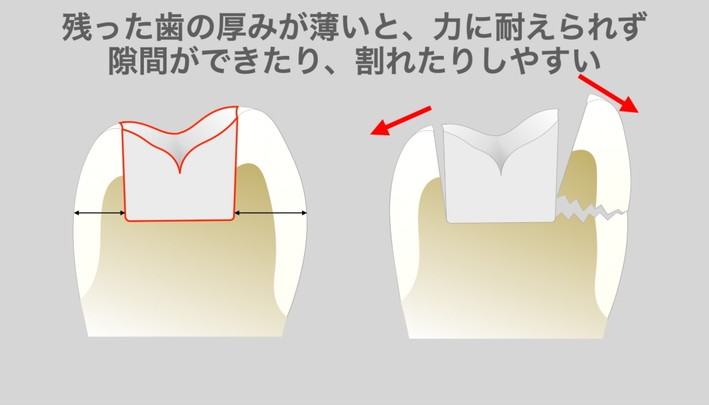 image_tooltip alt_text