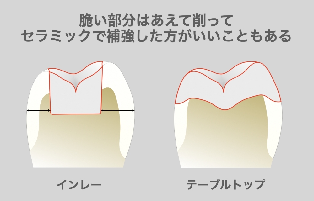 image_tooltip alt_text