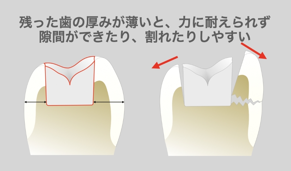 image_tooltip alt_text