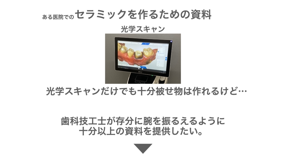 image_tooltip ある医院でのセラミックを作るための資料