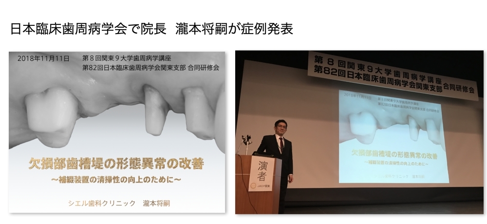 日本臨床歯周病学会で発表