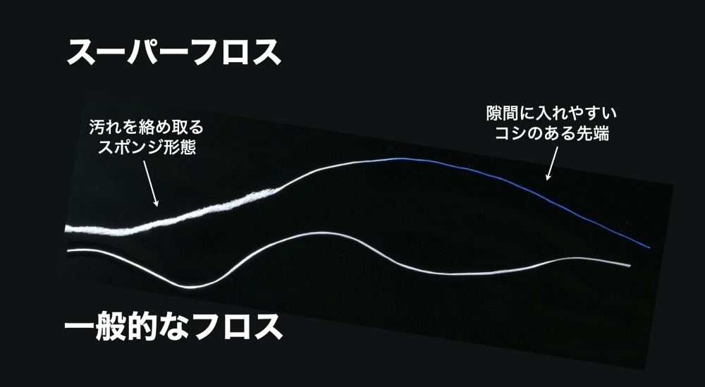 スーパーフロス