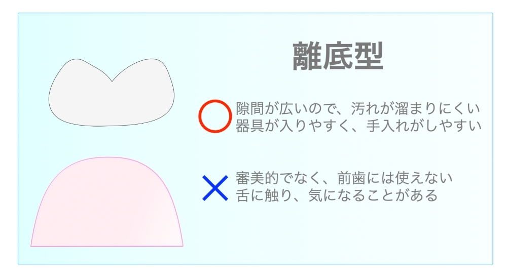 離底型

