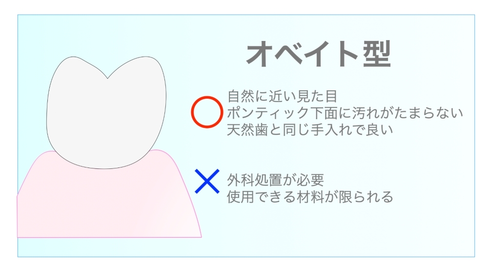 オベイト型